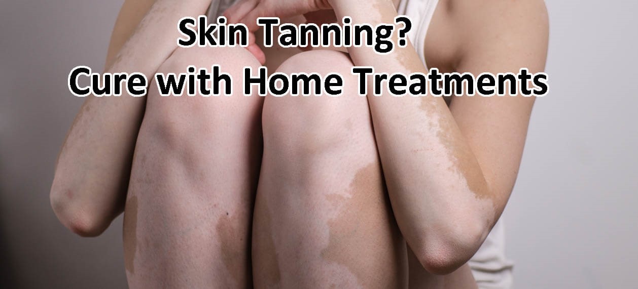 Cure White Spots On The Skin From Tanning Bed