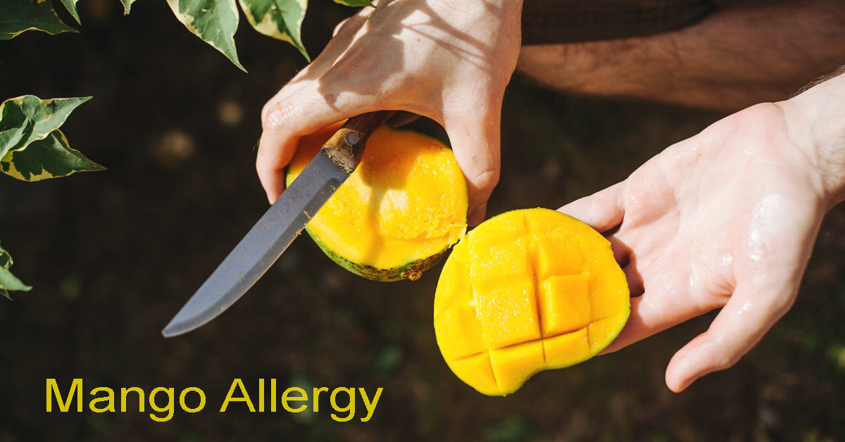 Mango Allergy Symptoms, Tests and Treatments Allergy Gate